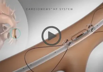 Malfunction With Abbott Heart Failure Cardiomes HF System